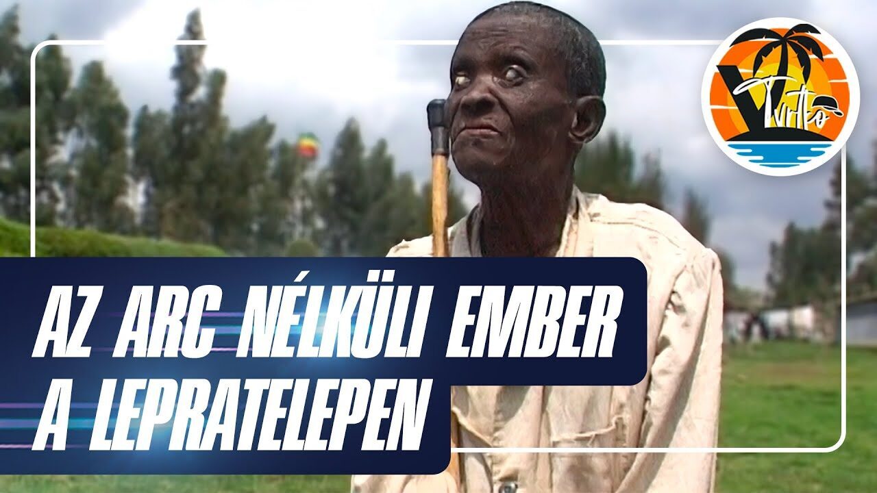 Arc nélküli emberek: a lepratelep titkai!