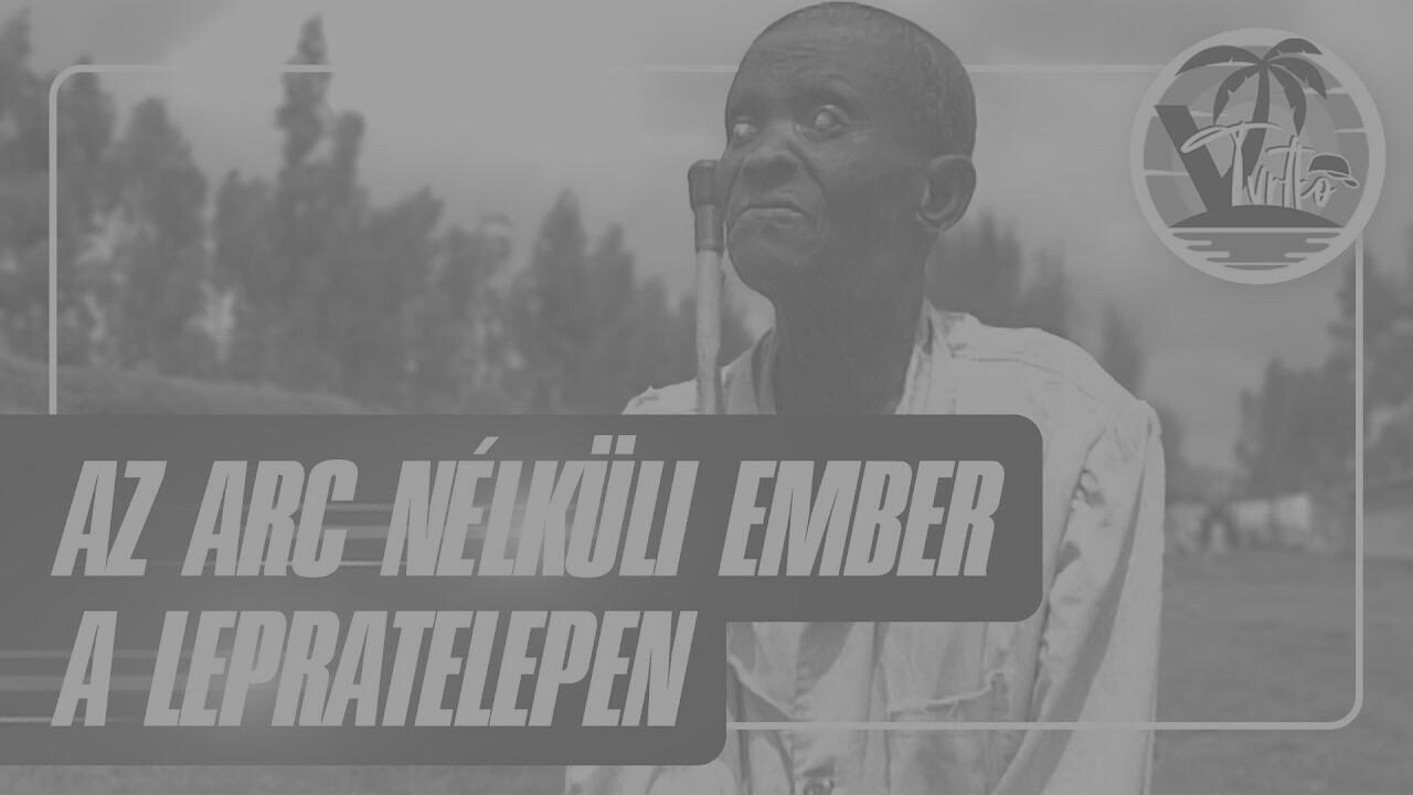Arc nélküli emberek: a lepratelep titkai!